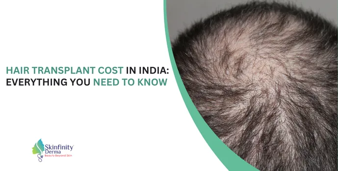 Hair Transplant Cost in India