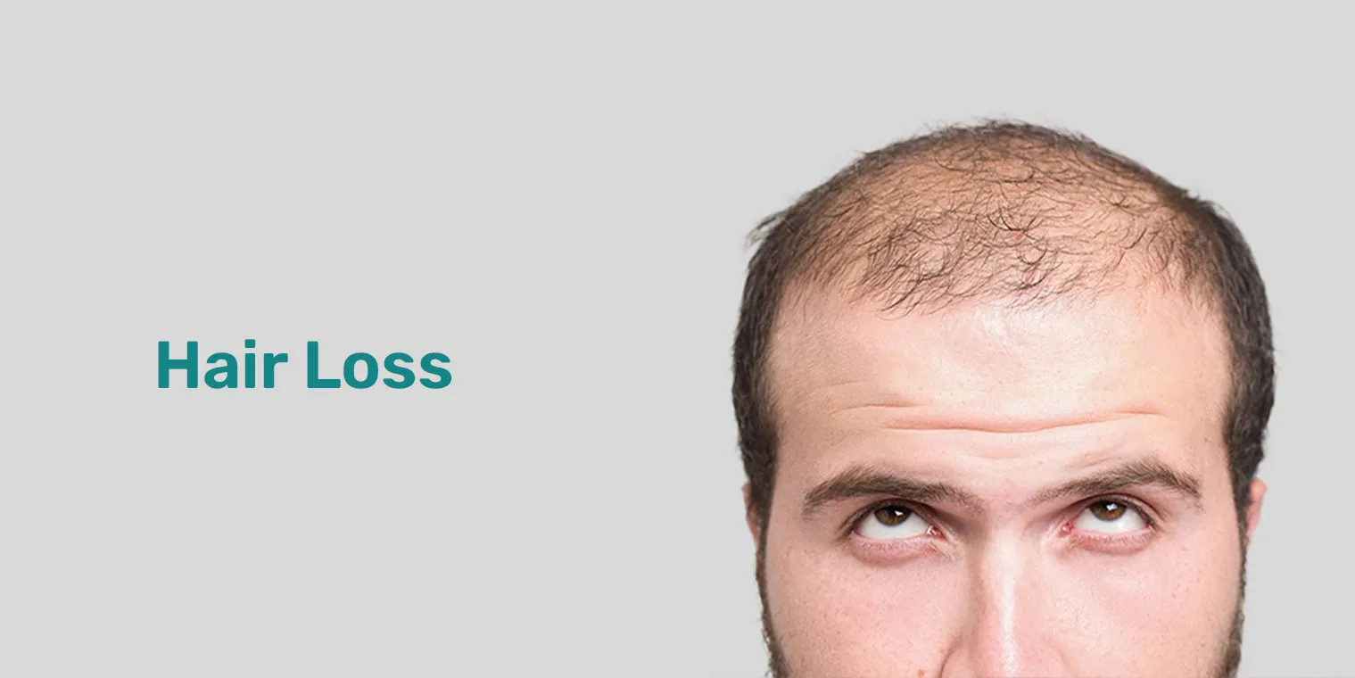 HAIR LOSS