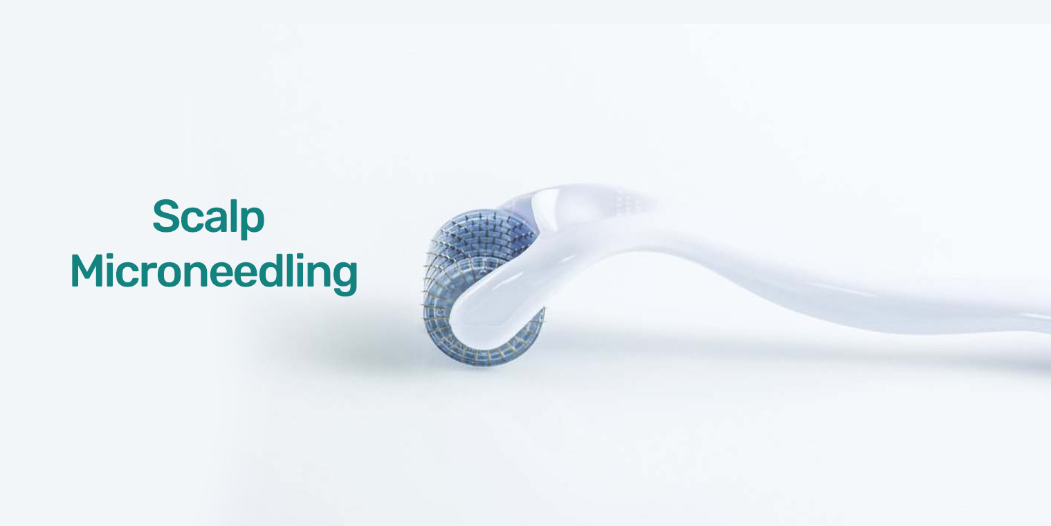 Scalp Microneedling