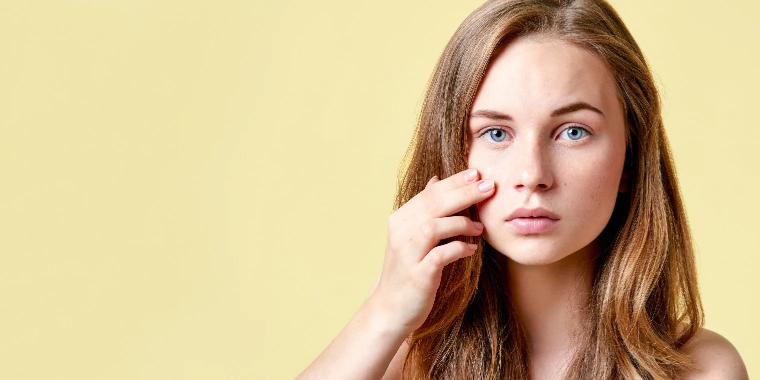 Best Acne & Scars Treatment in Noida: The Complete Guide to Acne Scar Removal