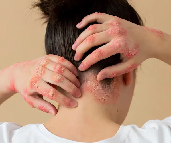 service-category-offer