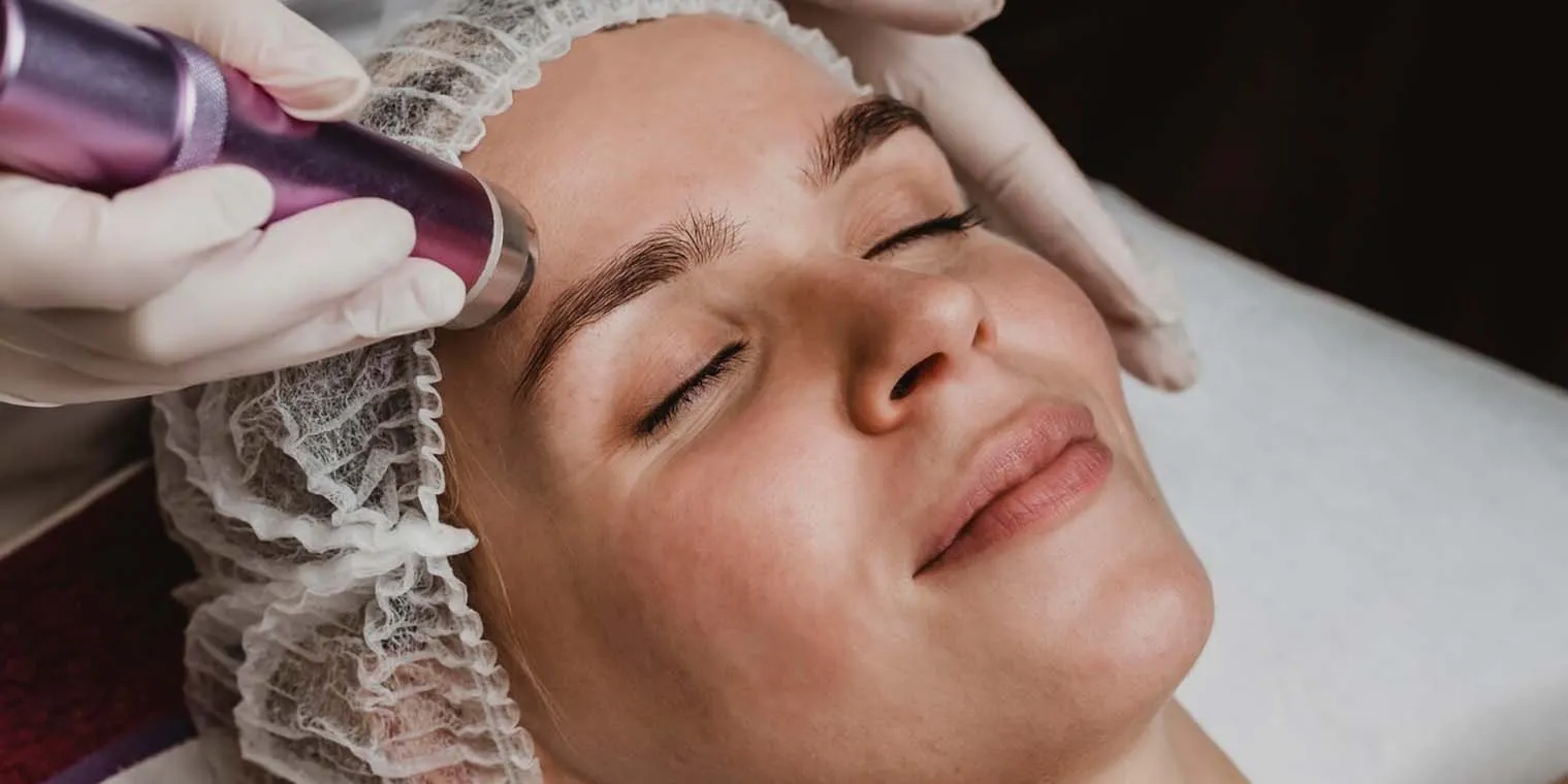  Microdermabrasion (MDA)