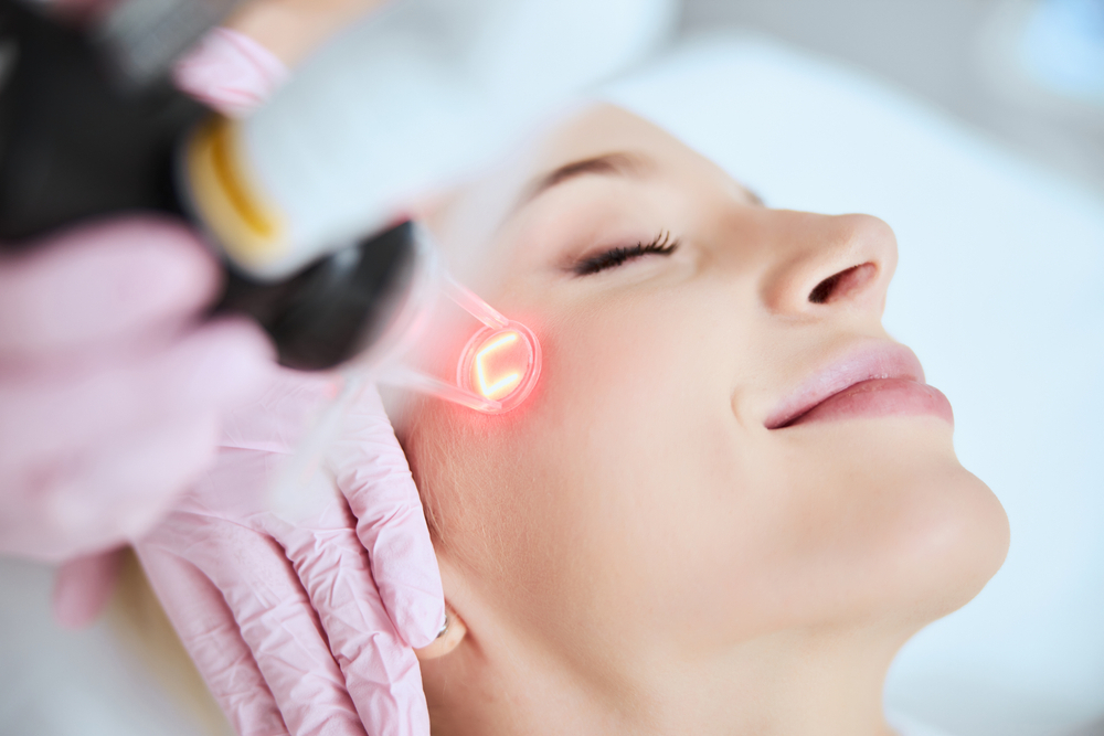 Skin Laser Treatment