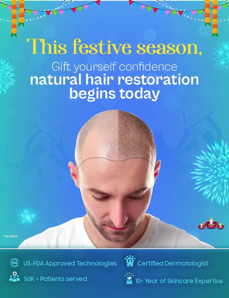 offerbanner
