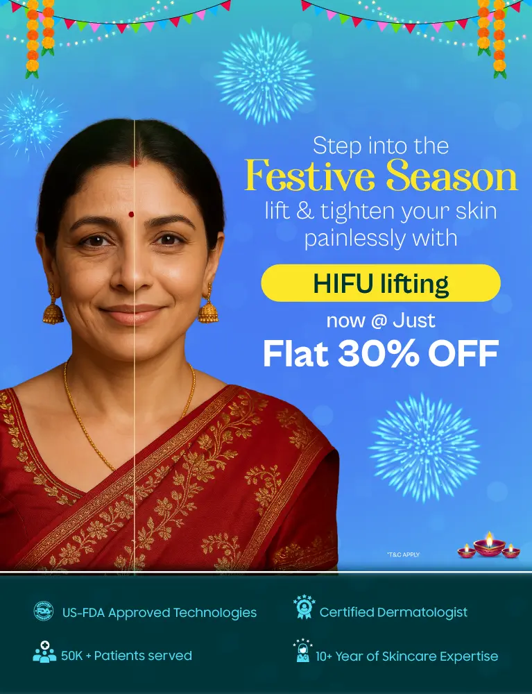 offerbanner