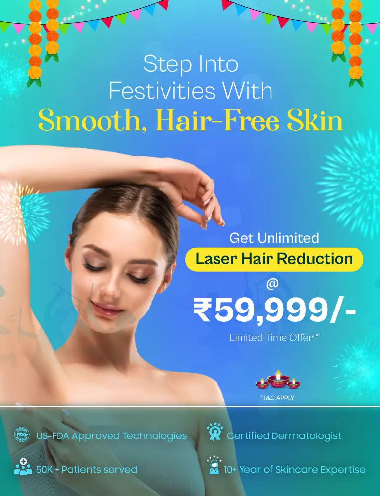 offerbanner