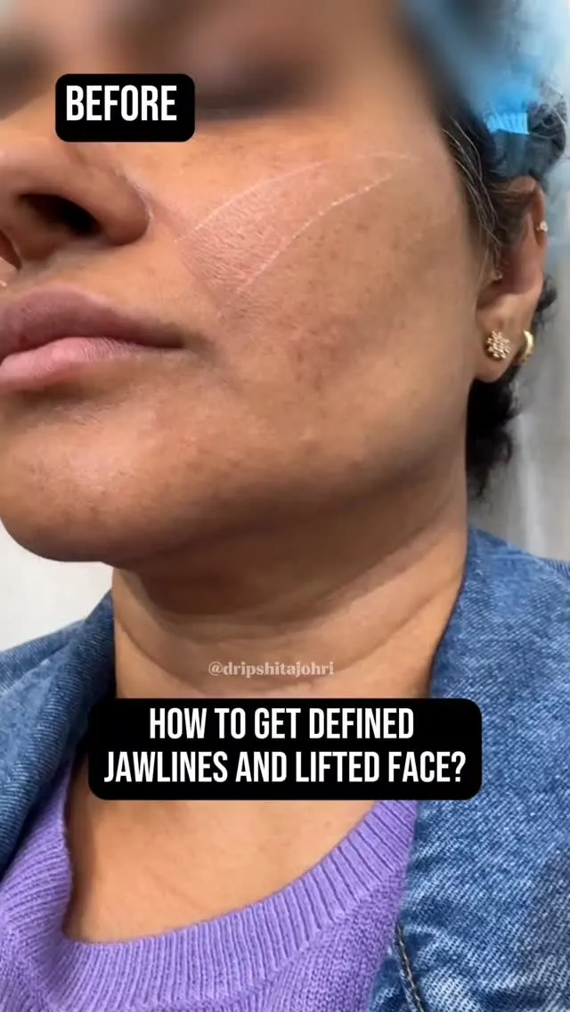 Instagram Reel – Skinfinity Derma