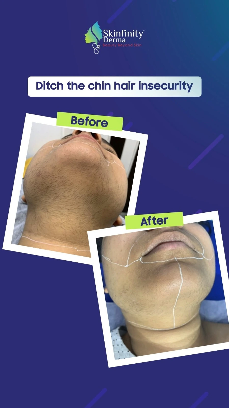 Instagram Reel – Skinfinity Derma