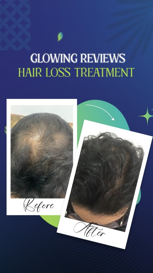 Instagram Reel – Skinfinity Derma