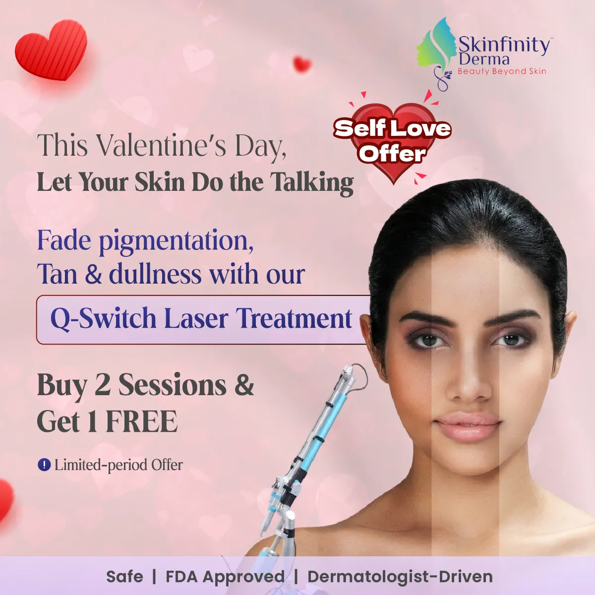 Q-Switch Laser Treatment