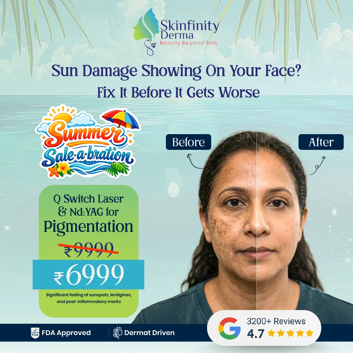 Pigmentation